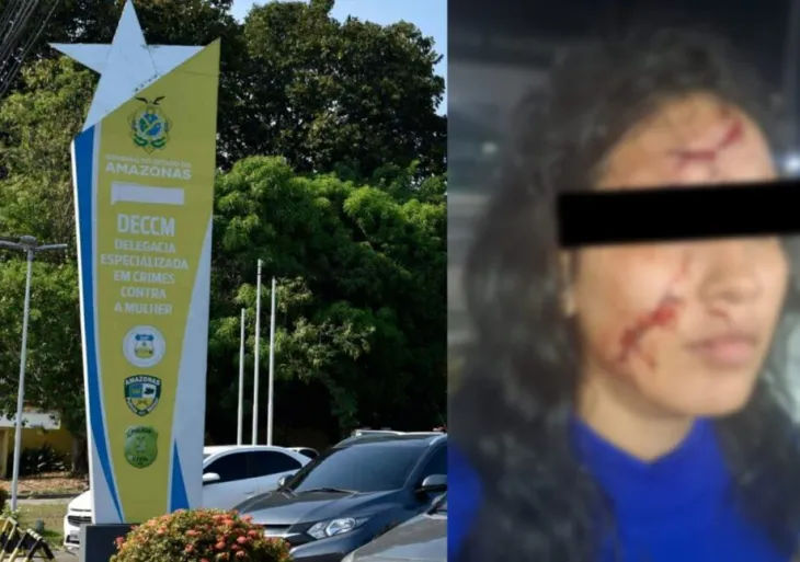 Violência Doméstica em Manaus: Mulher é Ferida com Estilhaços de Prato Pelo Ex-Companheiro Durante Discussão e Enfrenta Dificuldades para Registrar Ocorrência